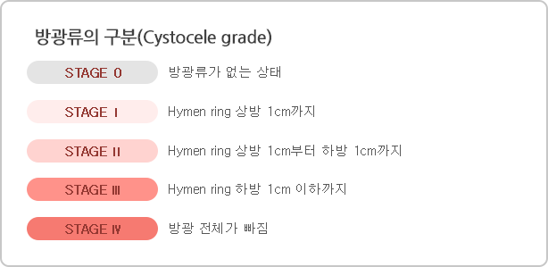 방광류의 구분(Cystocele grade)_STAGE 0_방광류가 없는 상태_STAGE 1_Hymen ring 상방 1cm까지_STAGE 2_Hymen ring 상방 1cm부터 하방 1cm까지_STAGE 3_Hymen ring 하방 1cm 이하까지_STAGE 4_방광 전체가 빠짐