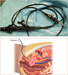 방광내시경 및 광학장비 사진