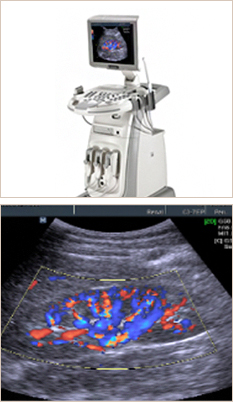 컬러도플러초음파 사진