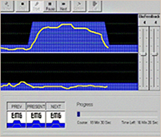 체외 Biofeedback 치료기 사진